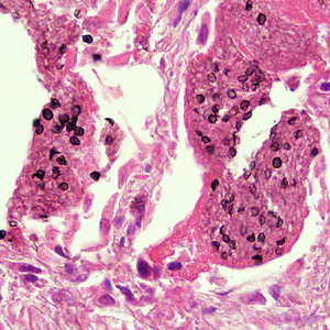 Case282_B.jpg
