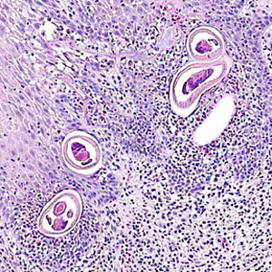 Case283_A.jpg