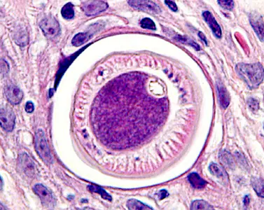 Case283_D.jpg