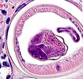 Case283_F.jpg