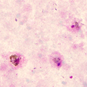 Case285_A.jpg