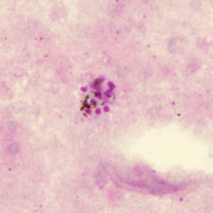 Case285_B.jpg