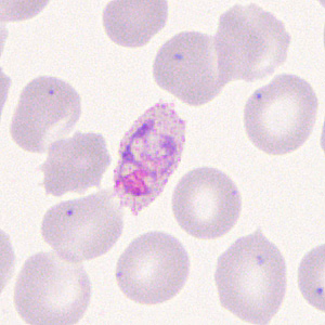 Case285_D.jpg