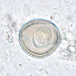 Case286_D.jpg