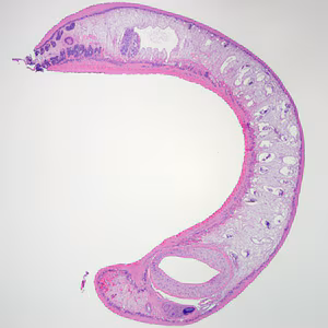 Case288_A.jpg