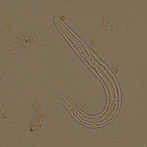 Case294_A.jpg
