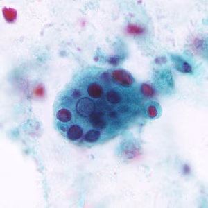 Case296_A.jpg