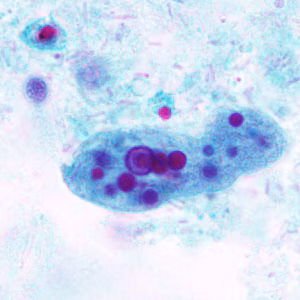 Case296_B.jpg