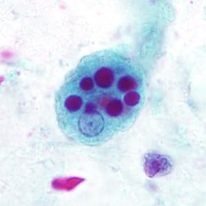 Case296_C.jpg