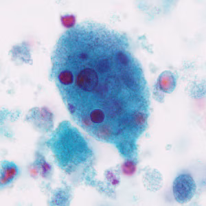 Case296_D.jpg