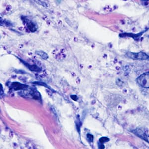 Case298_A.jpg