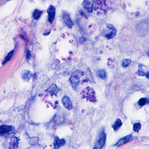 Case298_B.jpg