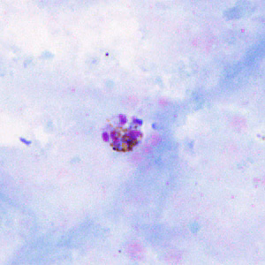 Case302_A.jpg