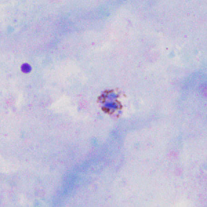 Case302_B.jpg