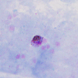 Case302_C.jpg