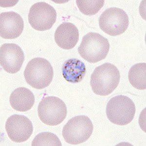 Case302_E.jpg