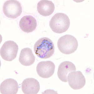 Case302_F.jpg