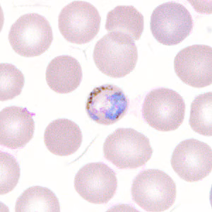 Case302_G.jpg