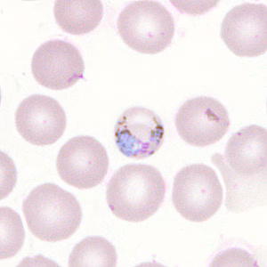 Case302_H.jpg