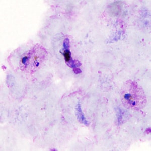 Case306_A.jpg