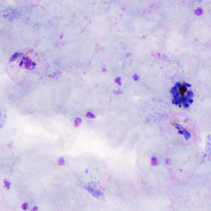Case306_B.jpg