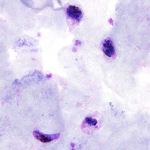 Case306_C.jpg