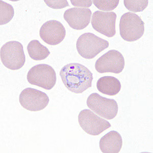 Case306_E.jpg