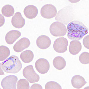 Case306_F.jpg