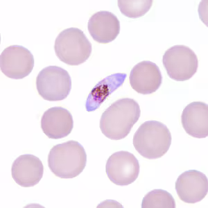 Case306_H.jpg