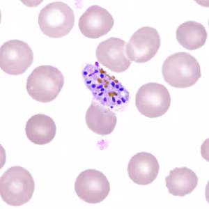 Case306_I.jpg