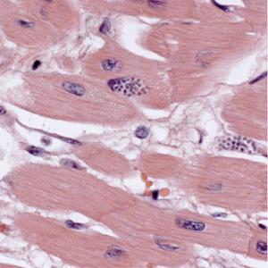 Case308_A.jpg