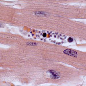 Case308_C.jpg