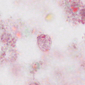 Case310_A.jpg