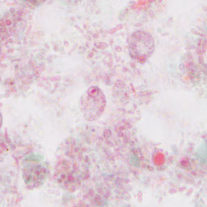 Case310_B.jpg