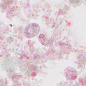 Case310_C.jpg