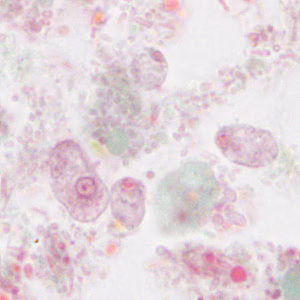 Case310_D.jpg