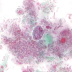 Case310_E.jpg