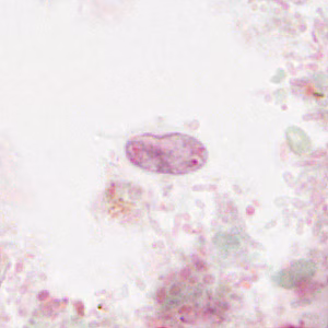 Case310_F.jpg