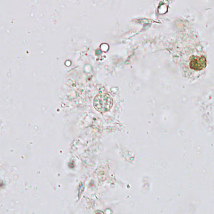 Case313_C.jpg