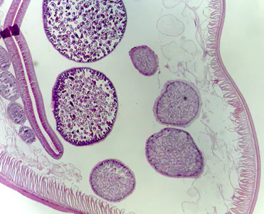 Case315_B.jpg