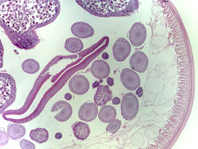Case315_C.jpg