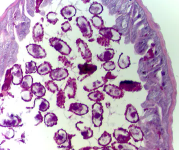 Case315_D.jpg