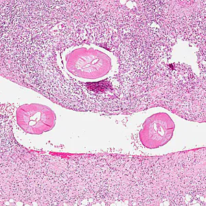 Case317_A.jpg