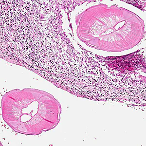 Case317_B.jpg