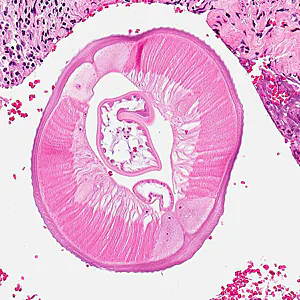 Case317_C.jpg