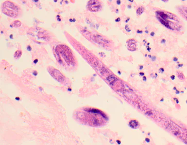 Case319_A.jpg