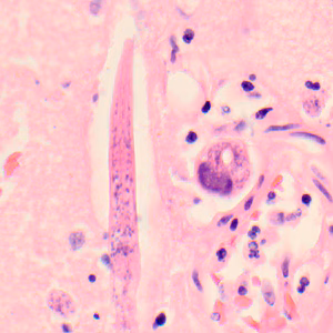 Case319_C.jpg