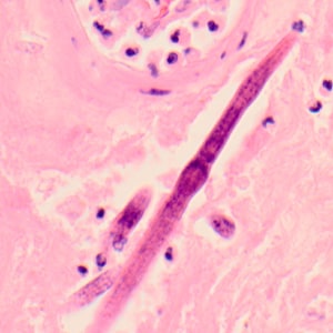 Case319_E.jpg