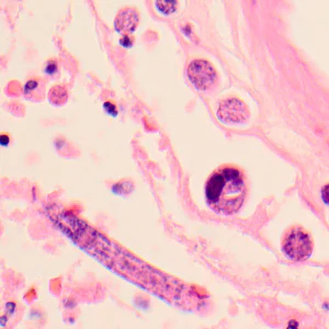 Case319_F.jpg