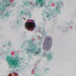 Case320_A.jpg